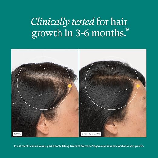 Nutrafol Women Hair Growth Supplements Ages 18-44 – Vegan 1-Month Bottle for Thicker, Healthier-Looking Hair