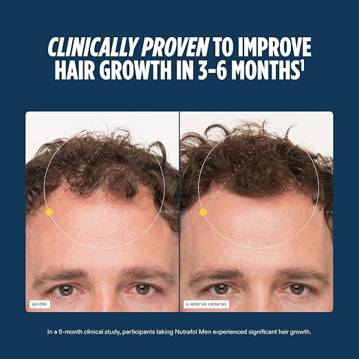 Nutrafol Men Hair Growth Supplements Ages 18–49 – 1-Month Bottle for Stronger, Thicker-Looking Hair