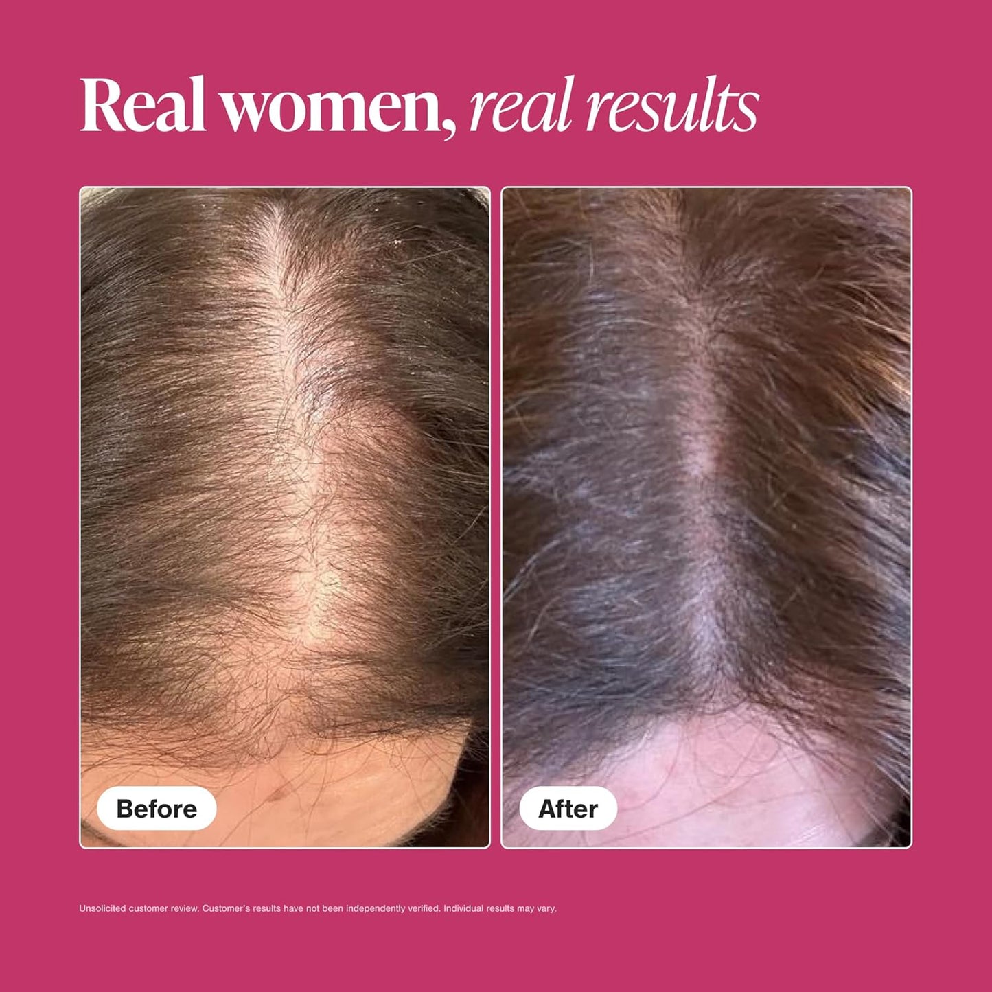 Viviscal Hair Growth Supplements for Women – Thicker, Fuller Hair Support for Thinning Hair