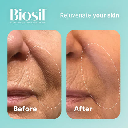 Biosil Collagen Generator Rsults 1
