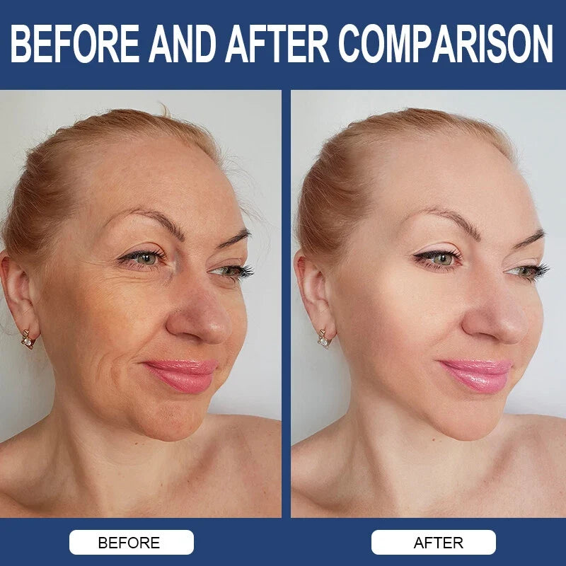 Hyaluronic Acid Anti-Aging Hydrating Capsules – Skin Hydration, Wrinkle Support & Joint Health