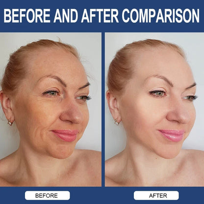 Hyaluronic Acid Anti-Aging Hydrating Capsules – Skin Hydration, Wrinkle Support & Joint Health